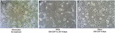 Validation of Induced Microglia-Like Cells (iMG Cells) for Future Studies of Brain Diseases